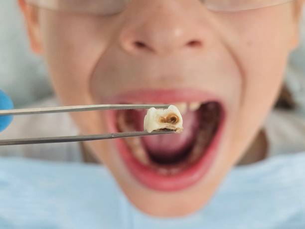 Best Emergency Gum Treatment in Charlotte, NC